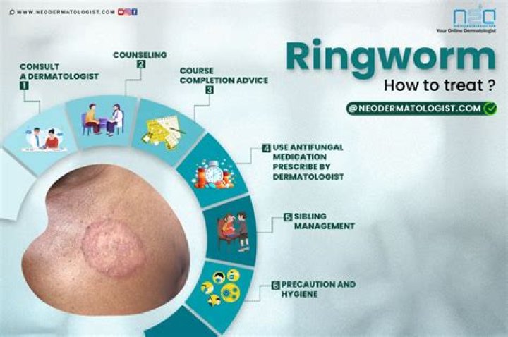 How do you treat ringworm in goats?